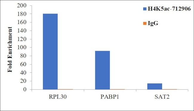 H4K5ac Antibody in ChIP Assay (ChIP)