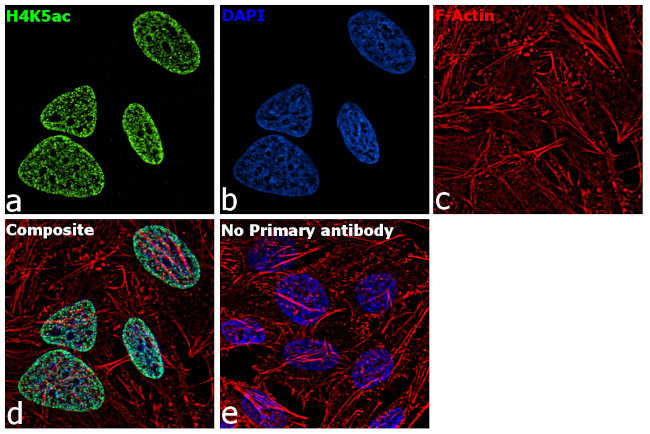 H4K5ac Antibody in Immunocytochemistry (ICC/IF)