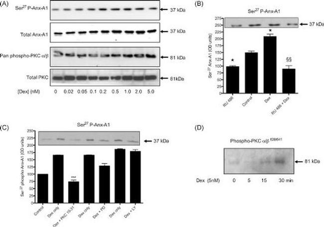 Annexin A1 Antibody in Western Blot (WB)