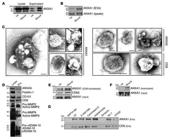 Annexin A1 Antibody in Western Blot (WB)