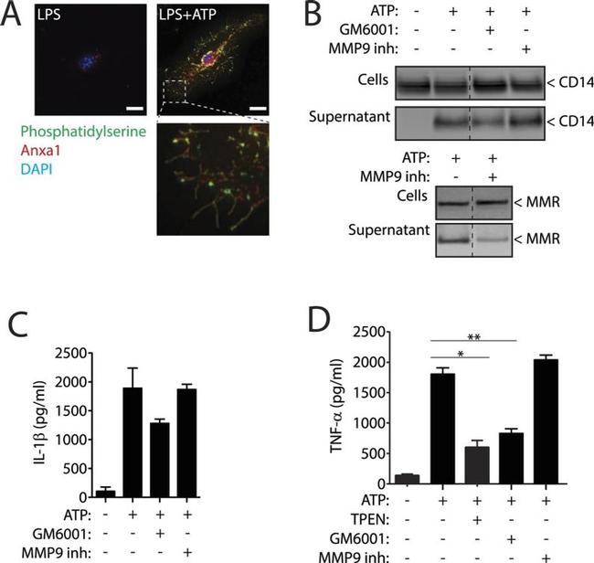 Annexin A1 Antibody in Immunocytochemistry (ICC/IF)