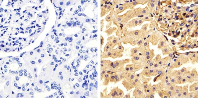 Annexin A1 Antibody in Immunohistochemistry (Paraffin) (IHC (P))