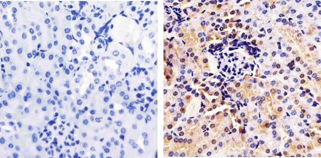 Annexin A1 Antibody in Immunohistochemistry (Paraffin) (IHC (P))