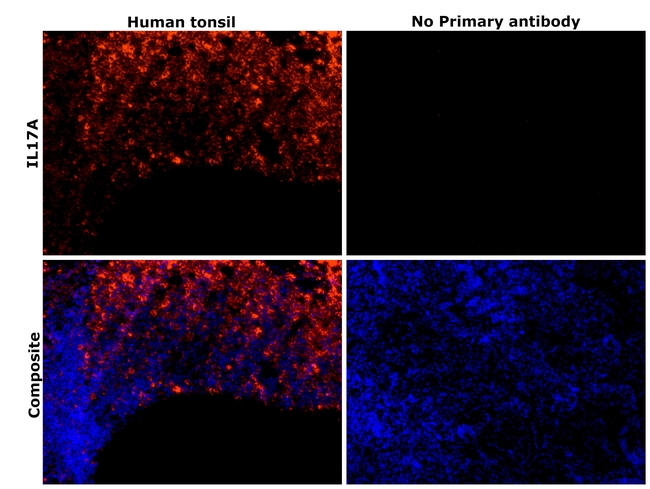 IL-17A Antibody in Immunohistochemistry (Paraffin) (IHC (P))