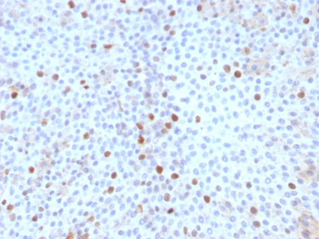 Topoisomerase II alpha (Proliferation and Drug-Resistance Marker) Antibody in Immunohistochemistry (Paraffin) (IHC (P))