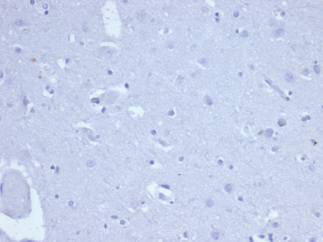 Topoisomerase II alpha Antibody in Immunohistochemistry (Paraffin) (IHC (P))