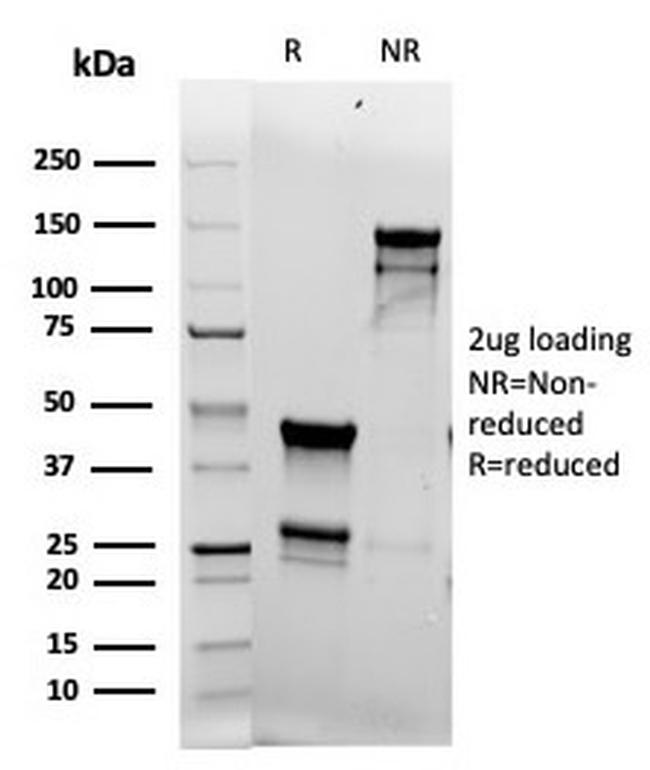 Topoisomerase II alpha Antibody in SDS-PAGE (SDS-PAGE)