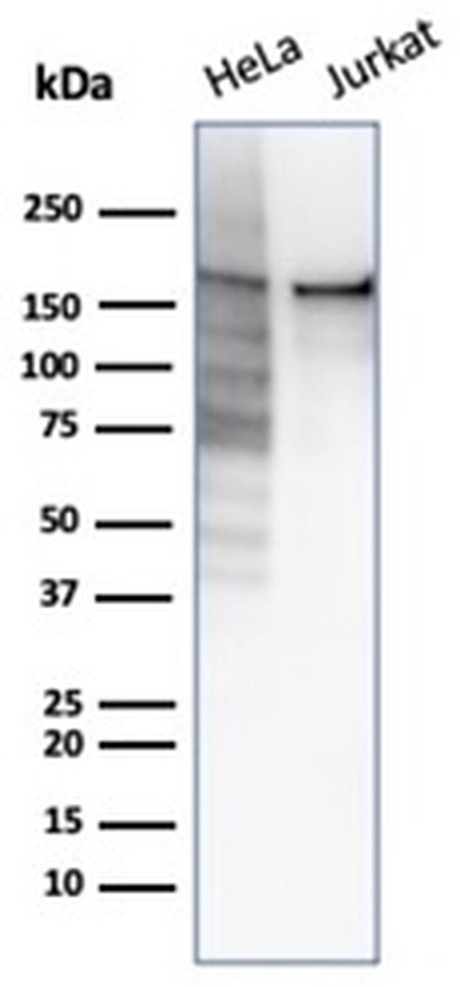 Topoisomerase II alpha Antibody in Western Blot (WB)