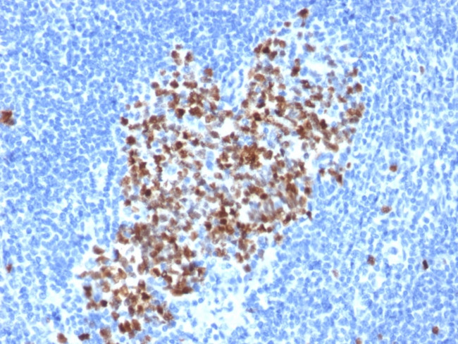 Topoisomerase II alpha Antibody in Immunohistochemistry (Paraffin) (IHC (P))