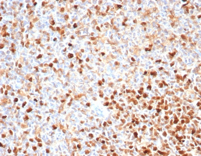 Topoisomerase II alpha (Proliferation and Drug-Resistance Marker) Antibody in Immunohistochemistry (Paraffin) (IHC (P))