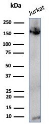 Topoisomerase II alpha (Proliferation and Drug-Resistance Marker) Antibody in Western Blot (WB)