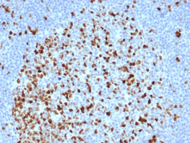 Topoisomerase II alpha Antibody in Immunohistochemistry (Paraffin) (IHC (P))