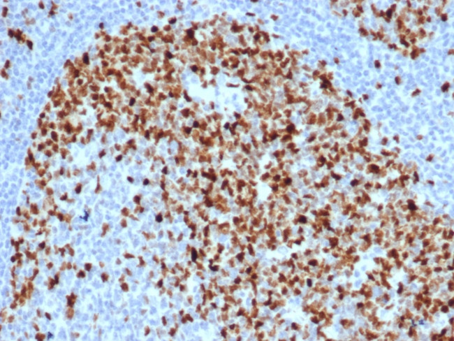 Topoisomerase II alpha Antibody in Immunohistochemistry (Paraffin) (IHC (P))