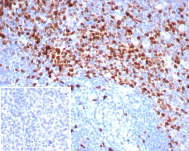 Topoisomerase II alpha (Proliferation and Drug-Resistance Marker) Antibody in Immunohistochemistry (Paraffin) (IHC (P))