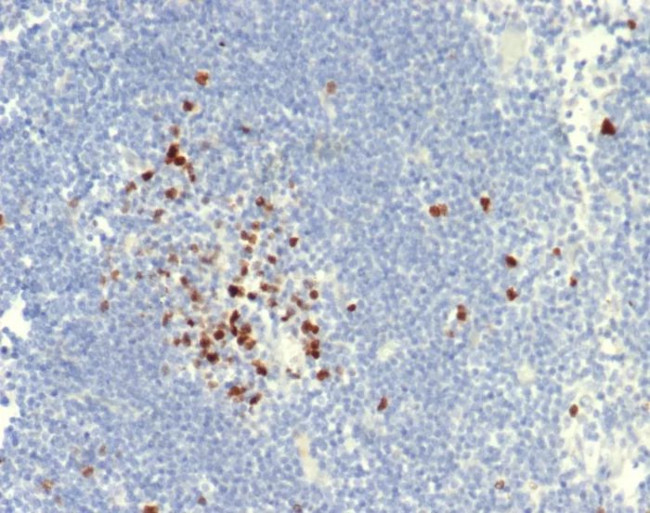 Topoisomerase II alpha (Proliferation and Drug-Resistance Marker) Antibody in Immunohistochemistry (Paraffin) (IHC (P))