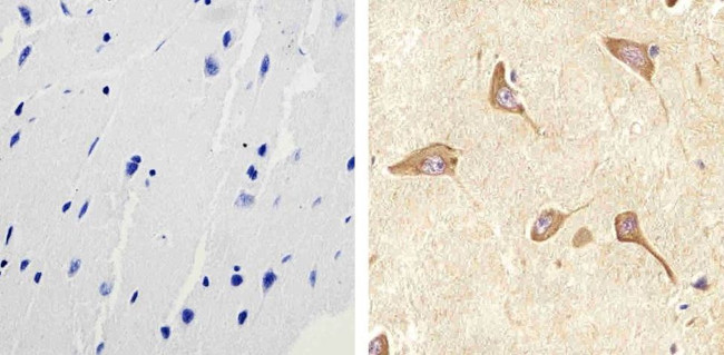 RAB11A Antibody in Immunohistochemistry (Paraffin) (IHC (P))