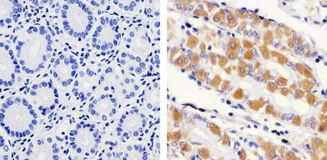 RAB11A Antibody in Immunohistochemistry (Paraffin) (IHC (P))