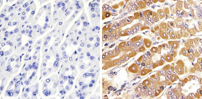 RAB11A Antibody in Immunohistochemistry (Paraffin) (IHC (P))