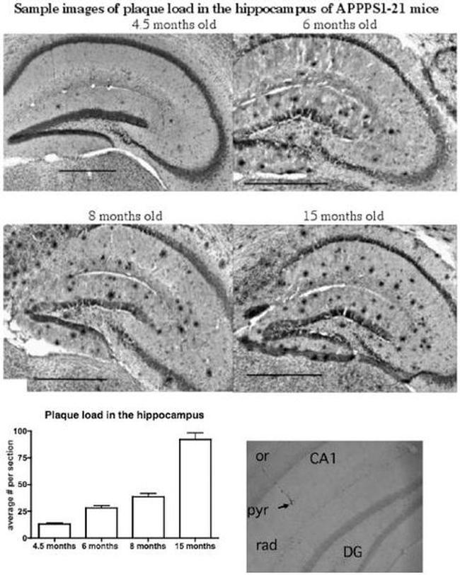 beta Amyloid Antibody in Immunohistochemistry (IHC)