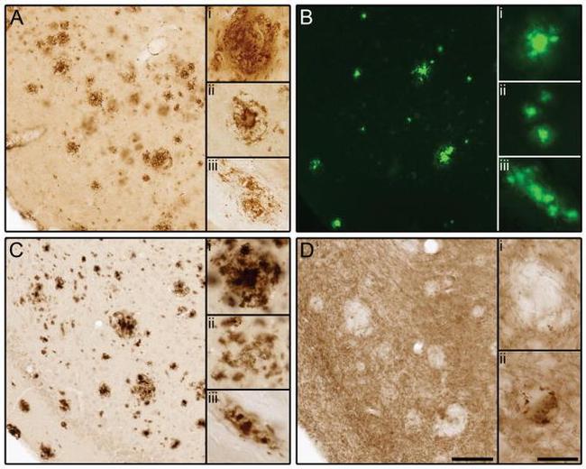 beta Amyloid Antibody in Immunohistochemistry (Frozen) (IHC (F))