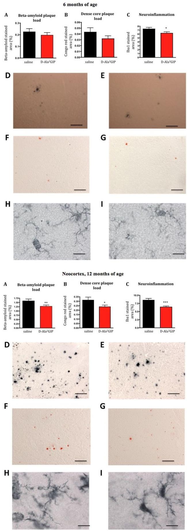 beta Amyloid Antibody in Immunohistochemistry (IHC)