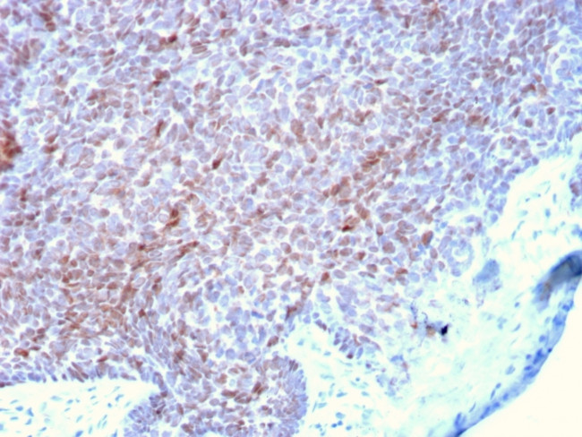 p73 (Tumor Suppressor) Antibody in Immunohistochemistry (Paraffin) (IHC (P))