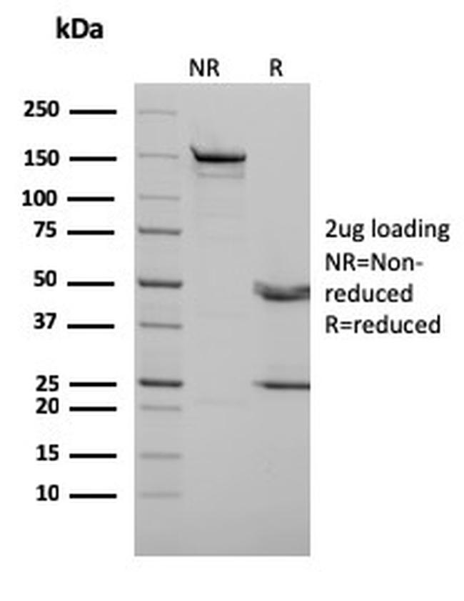 p73 (Tumor Suppressor) Antibody in SDS-PAGE (SDS-PAGE)