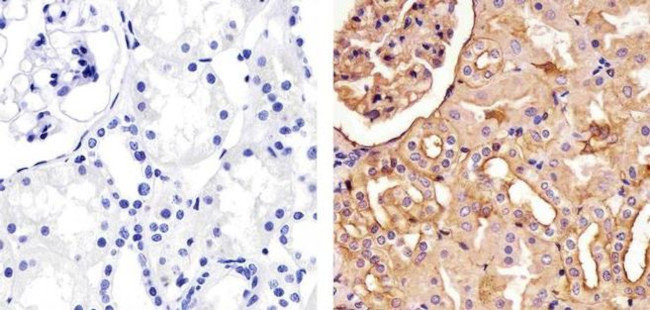 Pan-cadherin Antibody in Immunohistochemistry (Paraffin) (IHC (P))