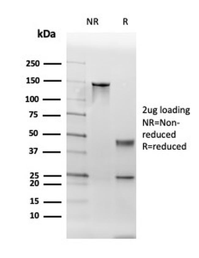 TPO (Thyroid Peroxidase) Antibody in SDS-PAGE (SDS-PAGE)