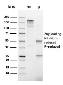 TPO (Thyroid Peroxidase) (Thyroid Marker) Antibody in SDS-PAGE (SDS-PAGE)