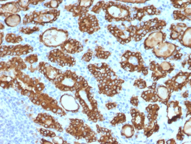 TPO (Thyroid Peroxidase) (Thyroid Marker) Antibody in Immunohistochemistry (Paraffin) (IHC (P))