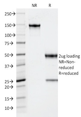 TPO (Thyroid Peroxidase) (Thyroid Marker) Antibody in SDS-PAGE (SDS-PAGE)