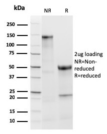 TPO (Thyroid Peroxidase) (Thyroid Marker) Antibody in SDS-PAGE (SDS-PAGE)