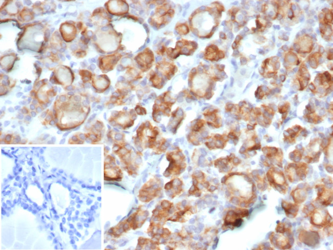 TPO (Thyroid Peroxidase) (Thyroid Marker) Antibody in Immunohistochemistry (Paraffin) (IHC (P))