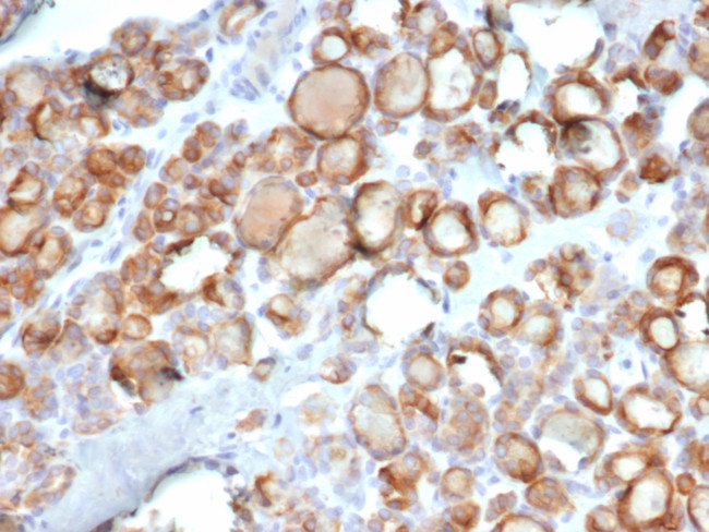 TPO (Thyroid Peroxidase) (Thyroid Marker) Antibody in Immunohistochemistry (Paraffin) (IHC (P))