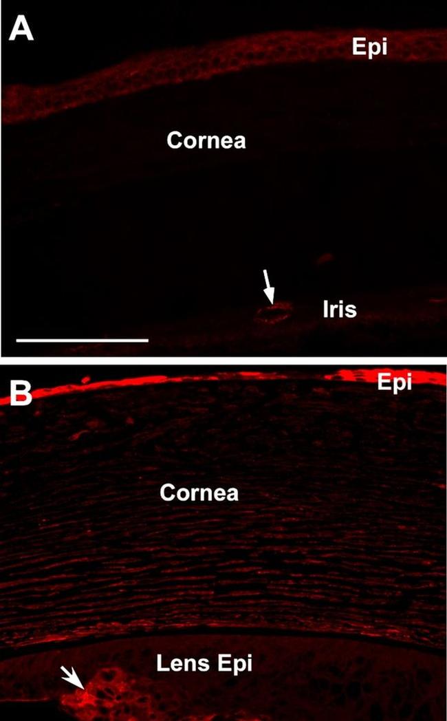 CDH11 Antibody in Immunohistochemistry (Paraffin) (IHC (P))