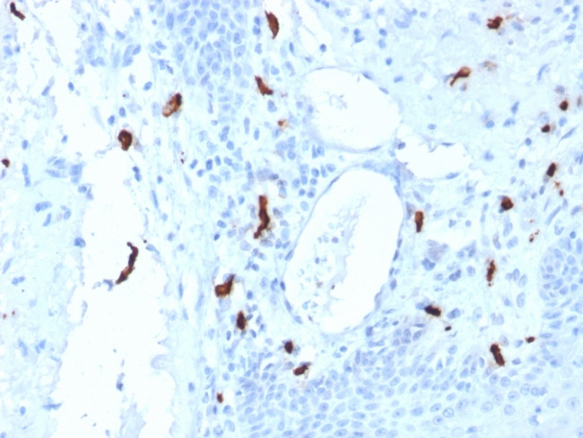 Tryptase Antibody in Immunohistochemistry (Paraffin) (IHC (P))