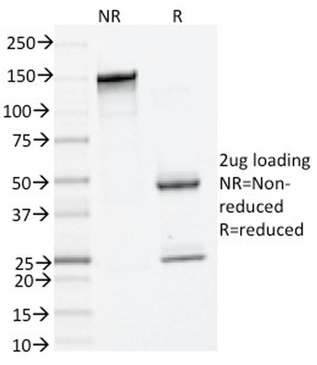 Tryptase Antibody in SDS-PAGE (SDS-PAGE)