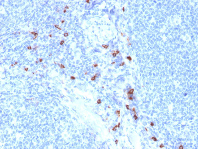 Tryptase (Mast Cell Marker) Antibody in Immunohistochemistry (Paraffin) (IHC (P))