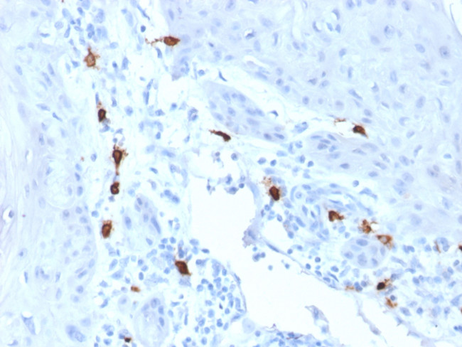 Tryptase (Mast Cell Marker) Antibody in Immunohistochemistry (Paraffin) (IHC (P))