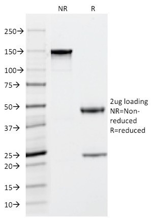 Tryptase (Mast Cell Marker) Antibody in SDS-PAGE (SDS-PAGE)