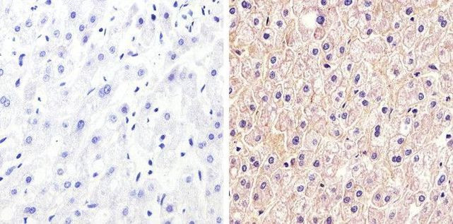 Claudin 1 Antibody in Immunohistochemistry (Paraffin) (IHC (P))