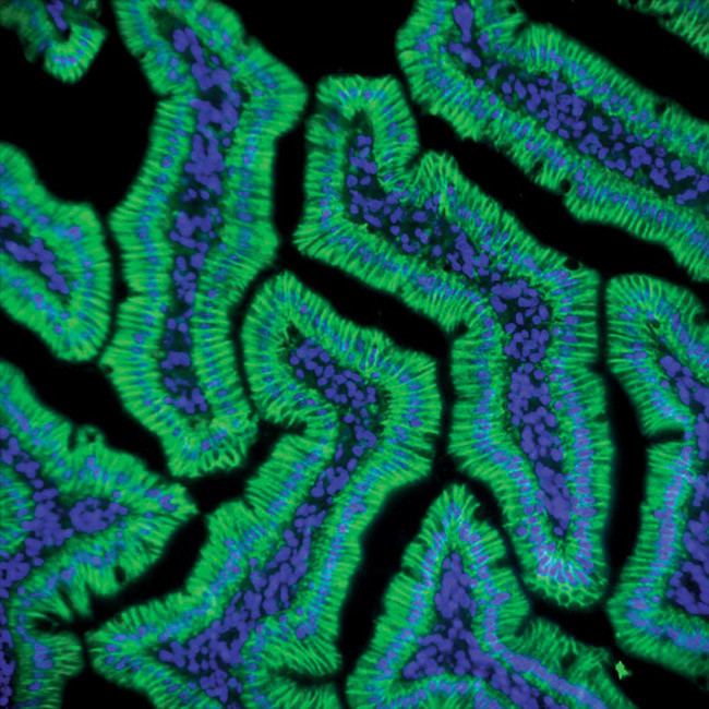 Claudin 1 Antibody in Immunohistochemistry (IHC)