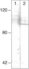 Phospho-STAT4 (Tyr693) Antibody in Western Blot (WB)