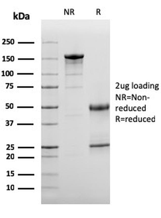 Complement 3d (C3d) Antibody in SDS-PAGE (SDS-PAGE)