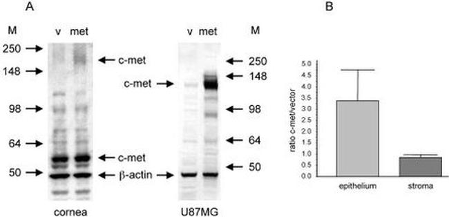 c-Met Antibody in Western Blot (WB)