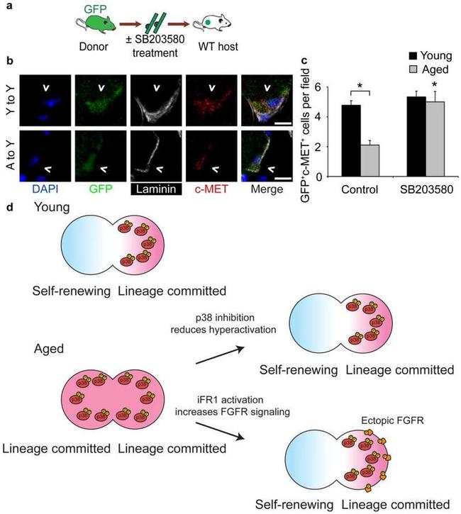 c-Met Antibody in Immunohistochemistry (IHC)