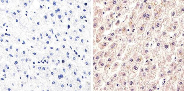 c-Met Antibody in Immunohistochemistry (Paraffin) (IHC (P))