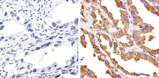 c-Met Antibody in Immunohistochemistry (Paraffin) (IHC (P))