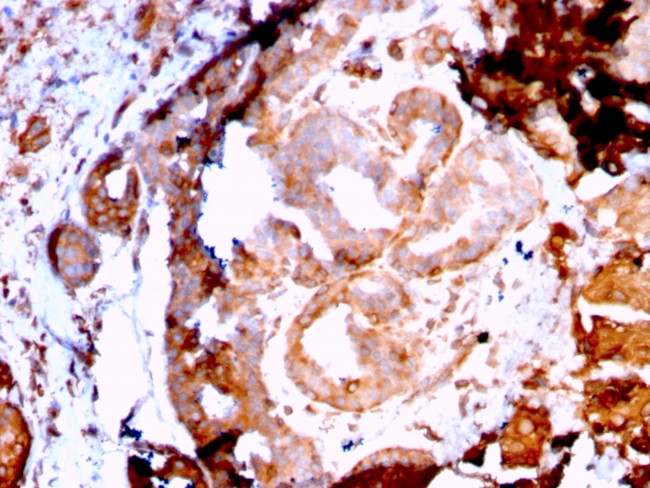 GRP94/HSP90B1 Antibody in Immunohistochemistry (Paraffin) (IHC (P))